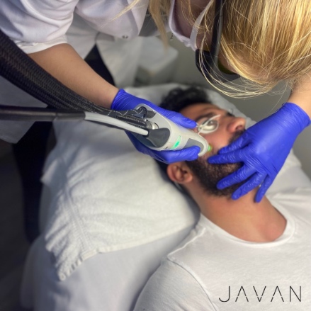 Laser Hair Removal
